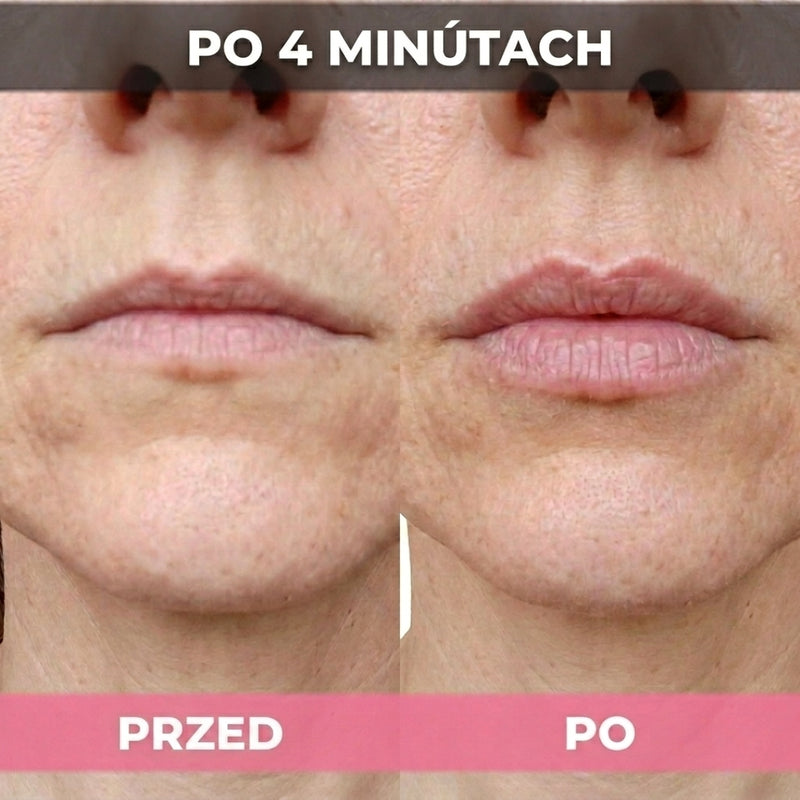 Slider Image 6