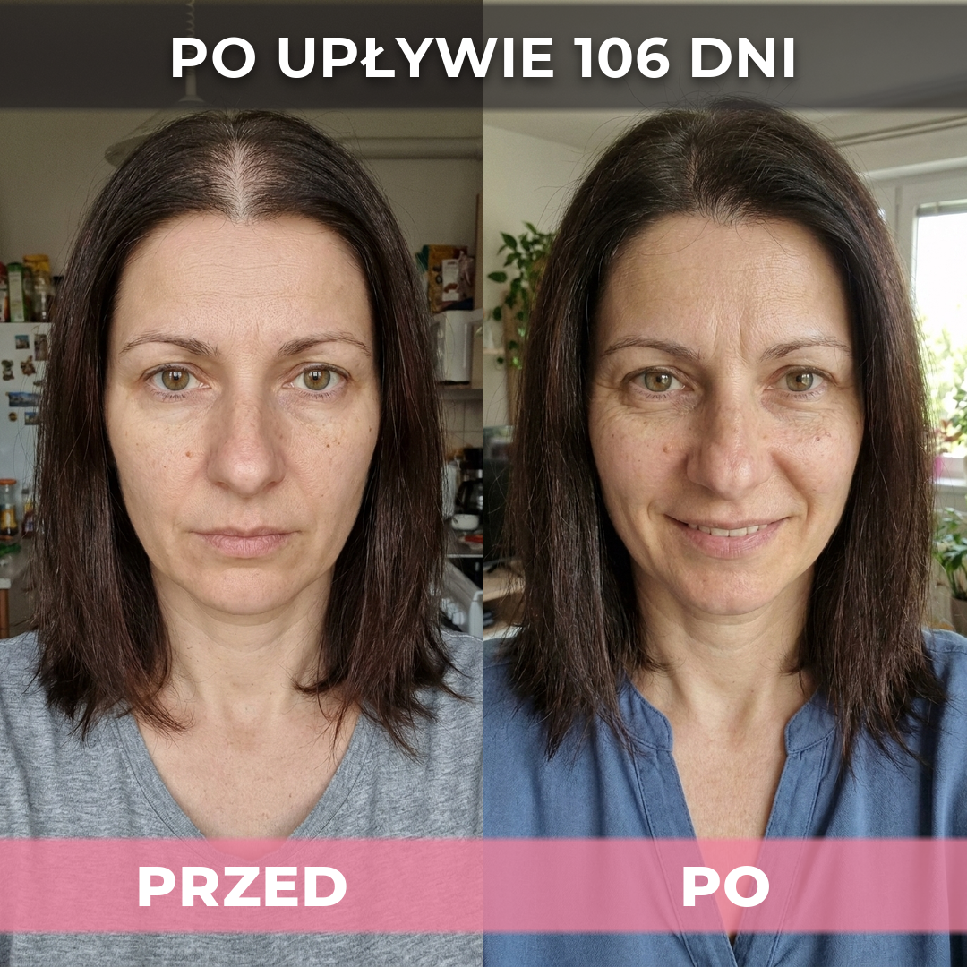 3 op. USA Hair Elixir Dla Kobiet – Niezwykle skutecznie pobudza porost włosów i zatrzymuje ich wypadanie