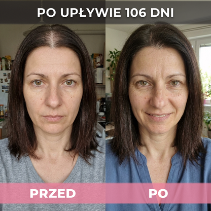 3 op. USA Hair Elixir Dla Kobiet – Niezwykle skutecznie pobudza porost włosów i zatrzymuje ich wypadanie