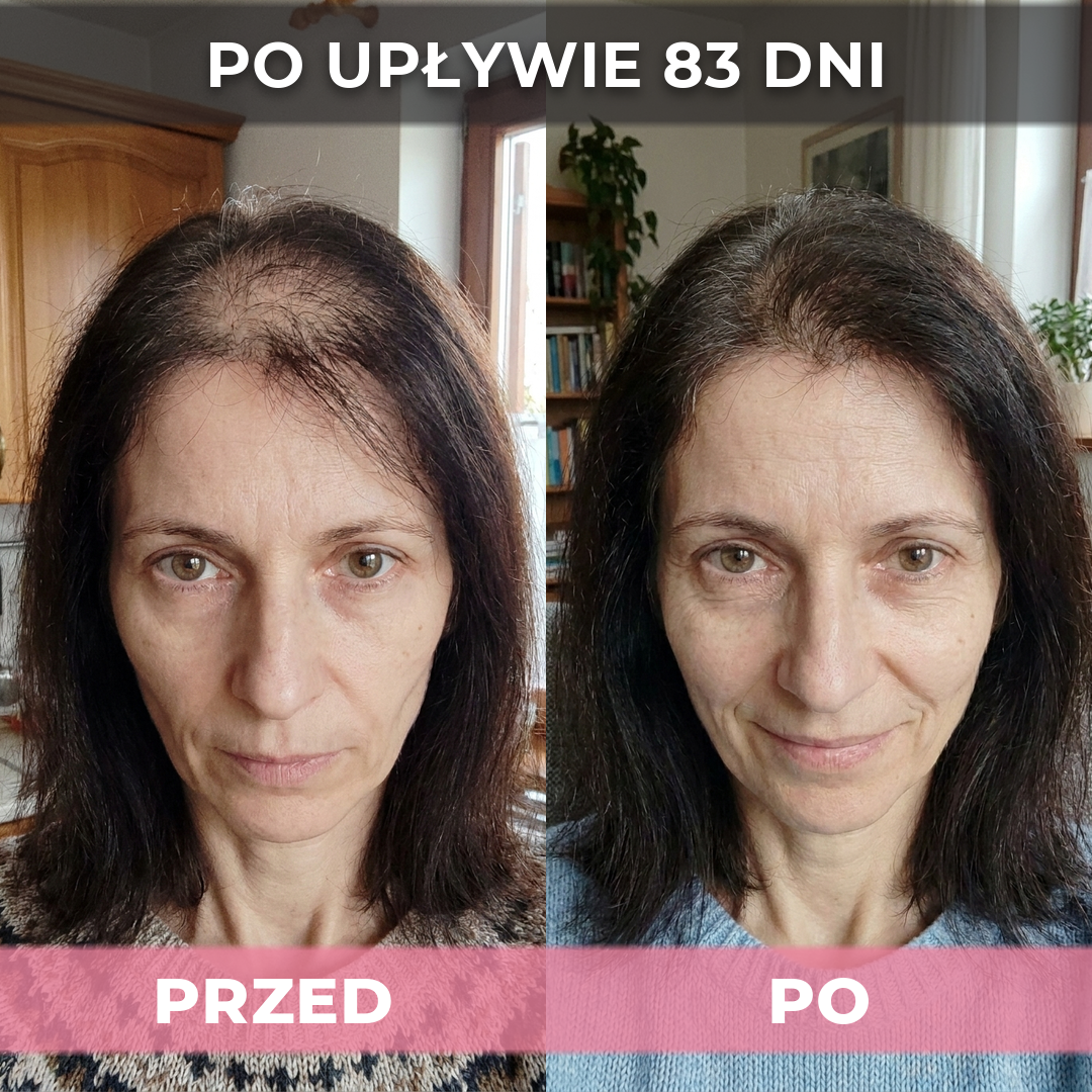 3 op. USA Hair Elixir Dla Kobiet – Niezwykle skutecznie pobudza porost włosów i zatrzymuje ich wypadanie