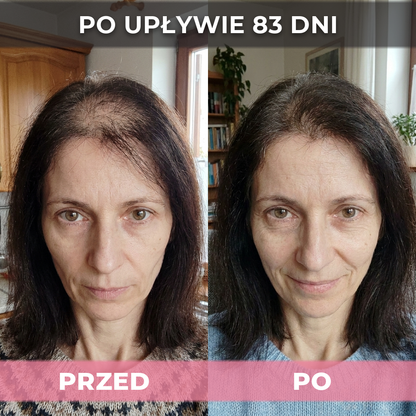 3 op. USA Hair Elixir Dla Kobiet – Niezwykle skutecznie pobudza porost włosów i zatrzymuje ich wypadanie