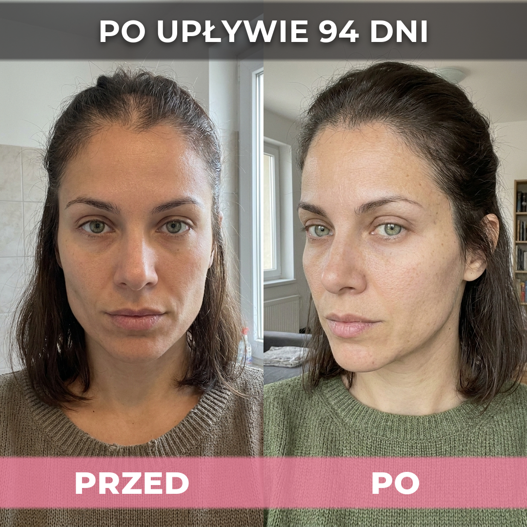 3 op. USA Hair Elixir Dla Kobiet – Niezwykle skutecznie pobudza porost włosów i zatrzymuje ich wypadanie