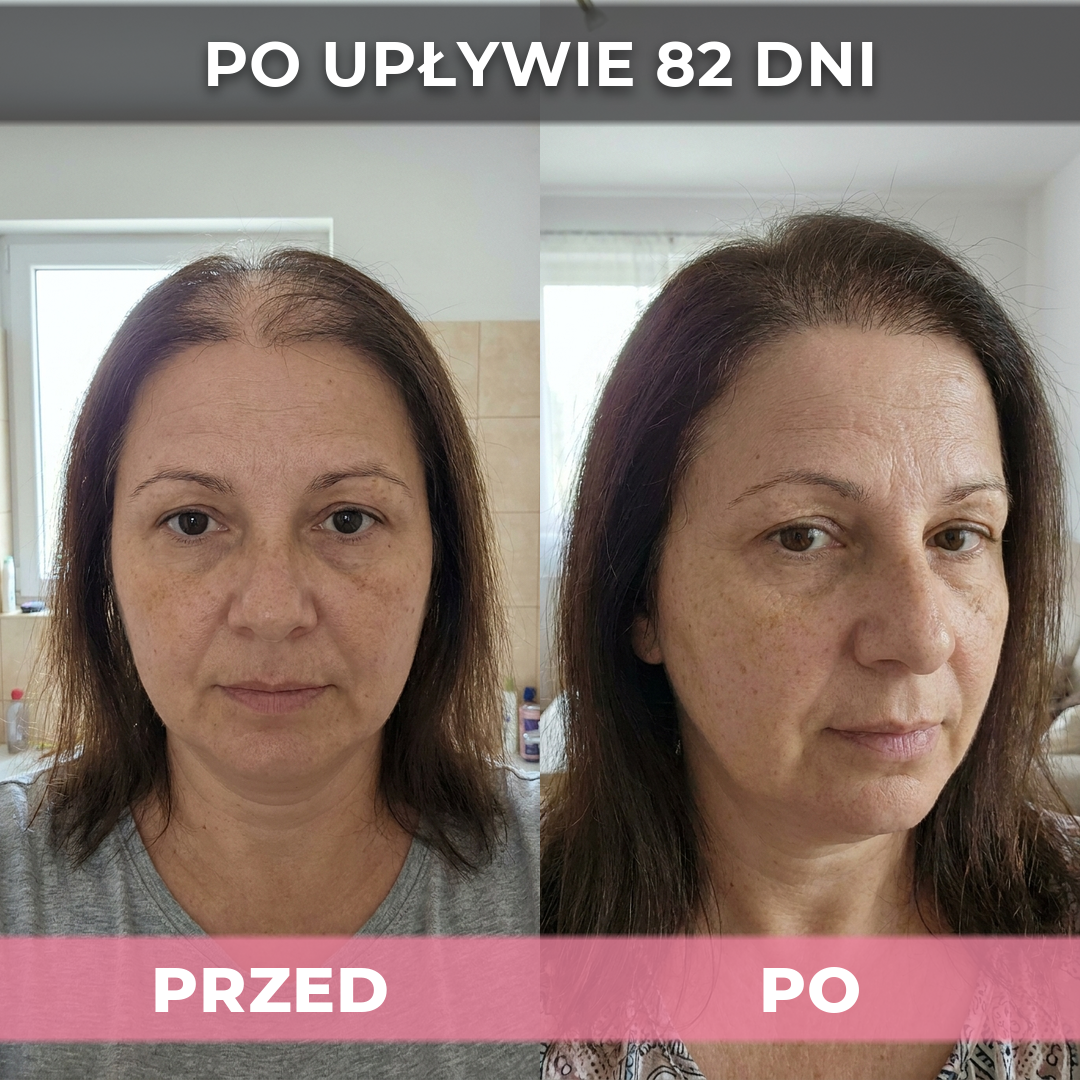 3 op. USA Hair Elixir Dla Kobiet – Niezwykle skutecznie pobudza porost włosów i zatrzymuje ich wypadanie