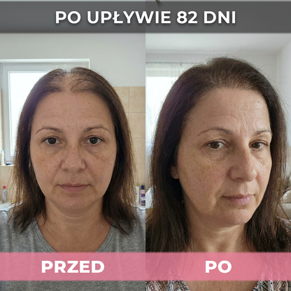 3 op. USA Hair Elixir Dla Kobiet – Niezwykle skutecznie pobudza porost włosów i zatrzymuje ich wypadanie