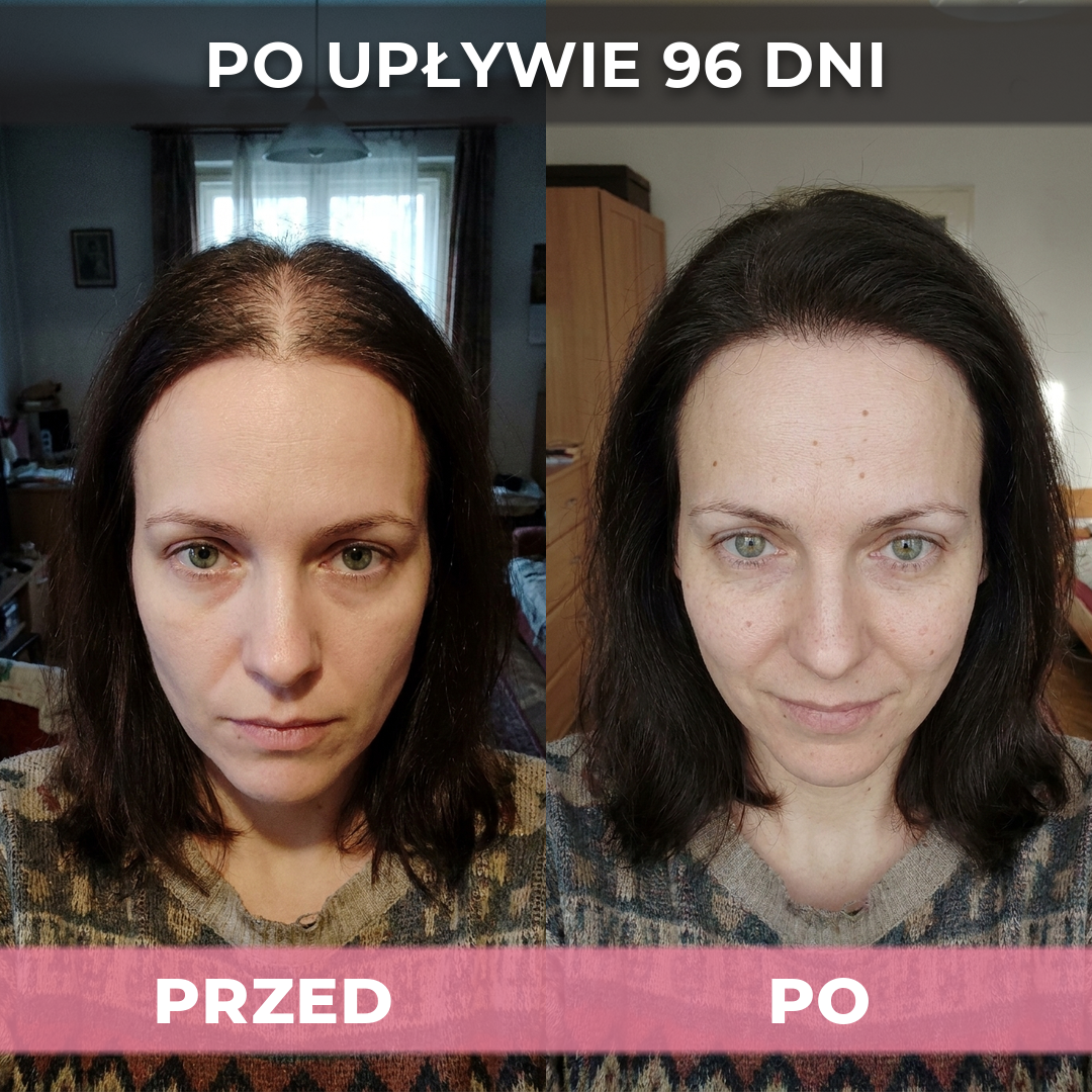 3 op. USA Hair Elixir Dla Kobiet – Niezwykle skutecznie pobudza porost włosów i zatrzymuje ich wypadanie