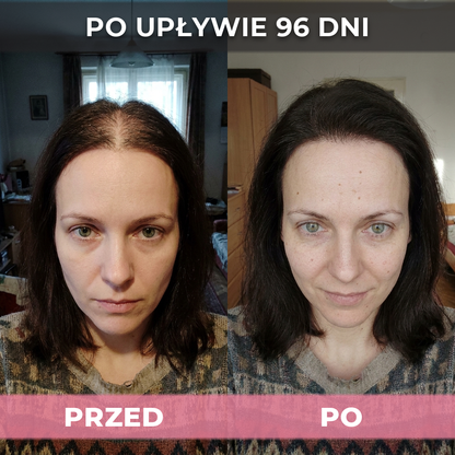 3 op. USA Hair Elixir Dla Kobiet – Niezwykle skutecznie pobudza porost włosów i zatrzymuje ich wypadanie