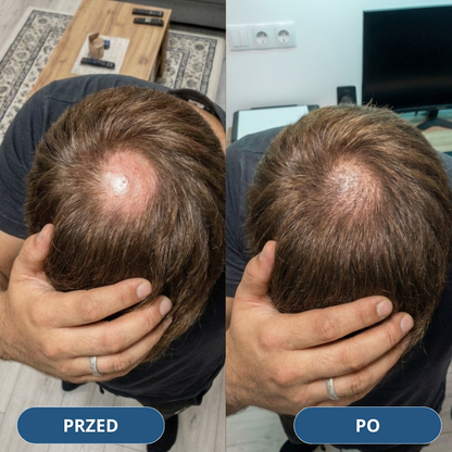 USA Hair Elixir dla mężczyzn – niezwykle skutecznie stymuluje porost włosów i hamuje ich wypadanie