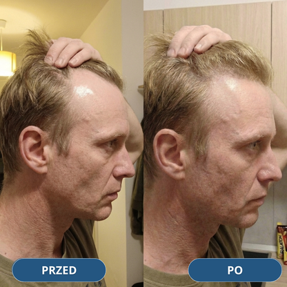 USA Hair Elixir dla mężczyzn – niezwykle skutecznie stymuluje porost włosów i hamuje ich wypadanie