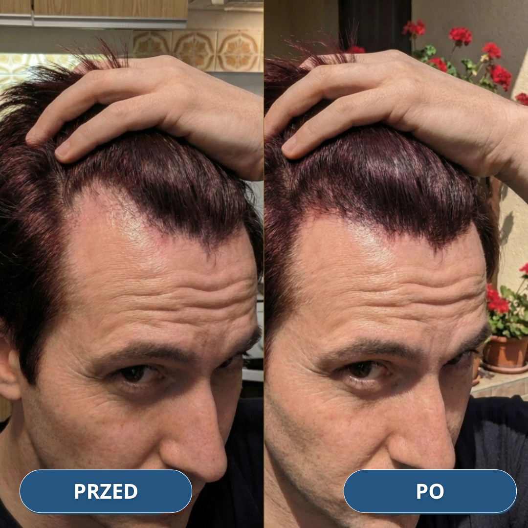USA Hair Elixir dla mężczyzn – niezwykle skutecznie stymuluje porost włosów i hamuje ich wypadanie