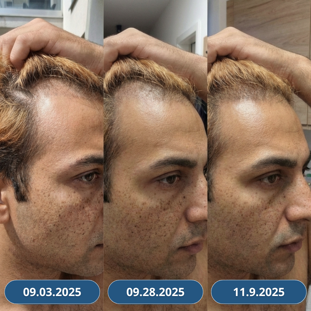 USA Hair Elixir dla mężczyzn – niezwykle skutecznie stymuluje porost włosów i hamuje ich wypadanie