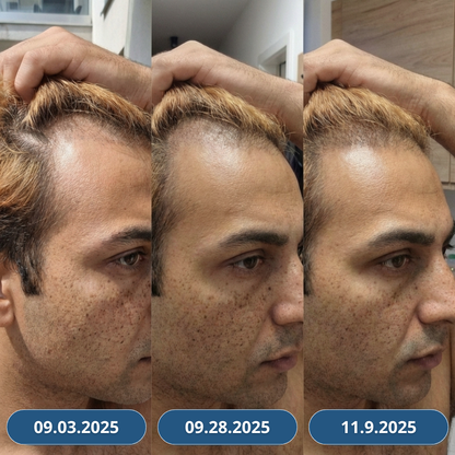 USA Hair Elixir dla mężczyzn – niezwykle skutecznie stymuluje porost włosów i hamuje ich wypadanie