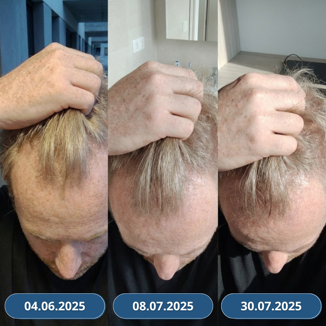 USA Hair Elixir dla mężczyzn – niezwykle skutecznie stymuluje porost włosów i hamuje ich wypadanie